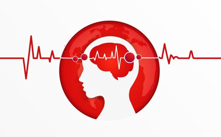 avc isquemico quando a trombectomia pode ser indicada
