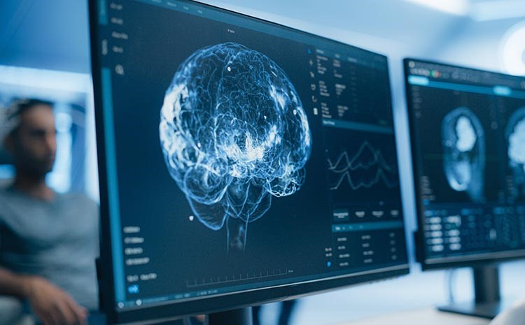 cavernoma e uma lesao congenita ou pode surgir ao longo da vida